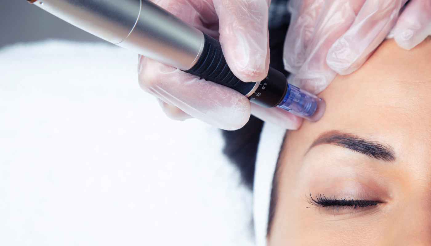 Microneedling à Bordeaux : découvrez l’institut Ozaliya !